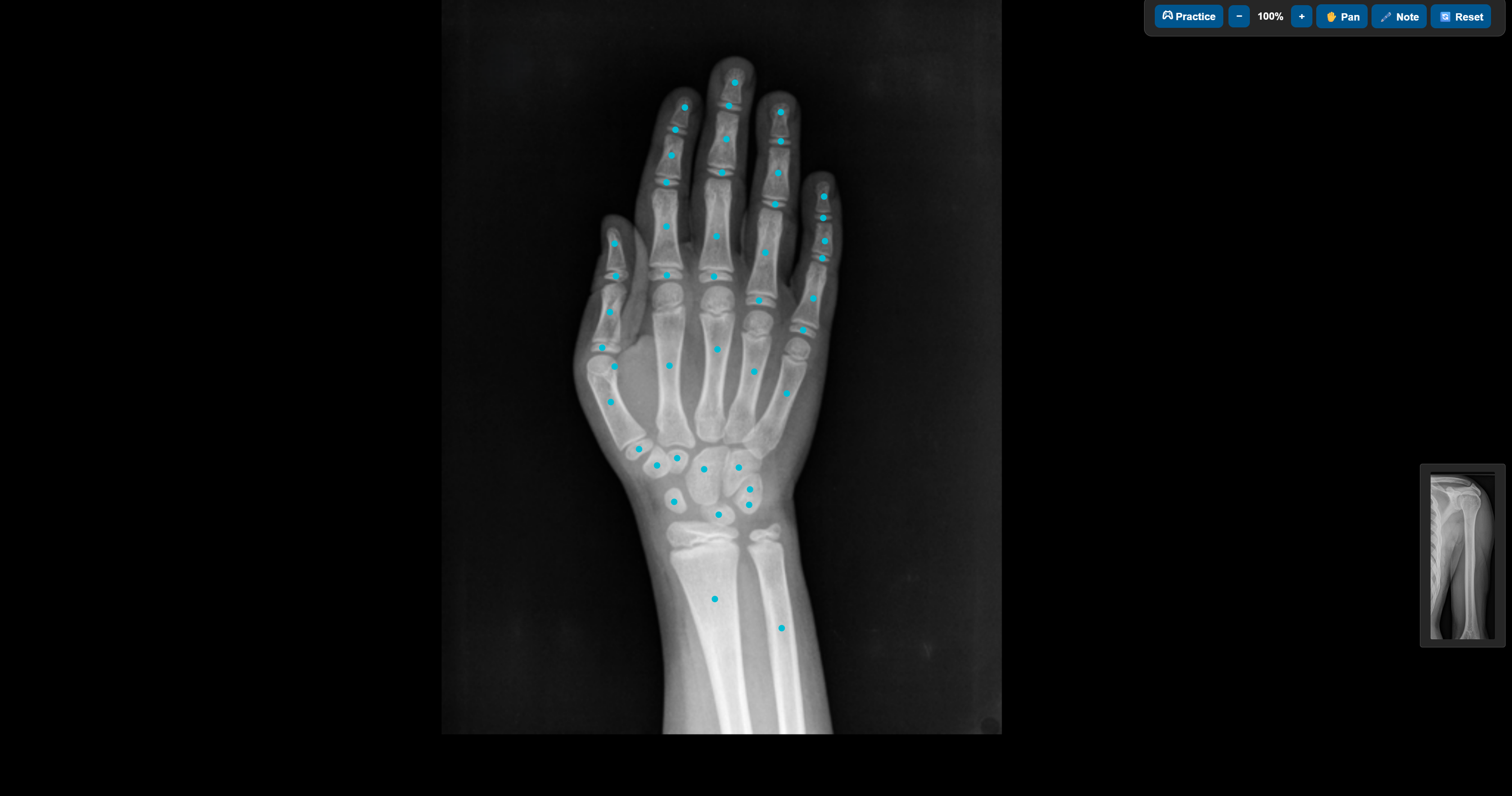 X-ray anatomy practice