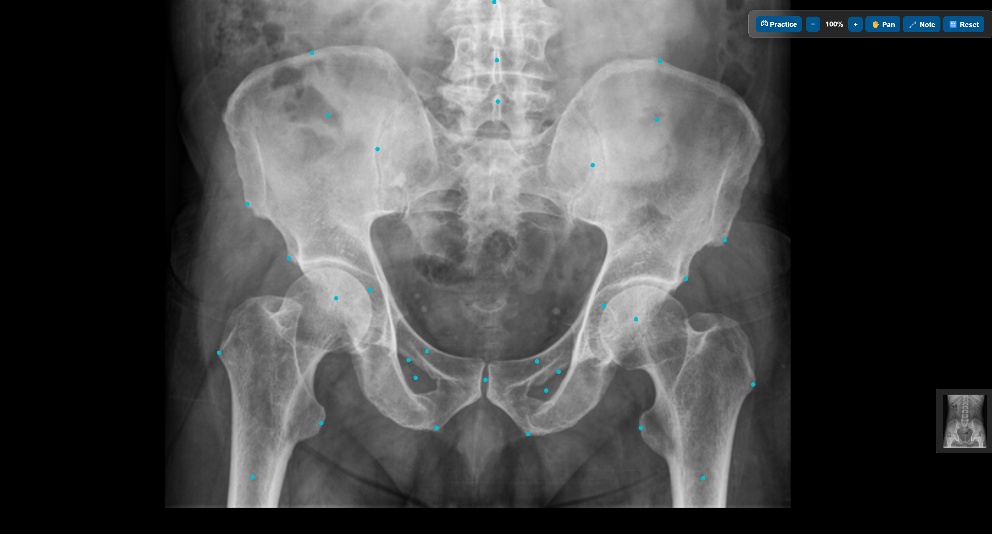 MRI anatomy practice