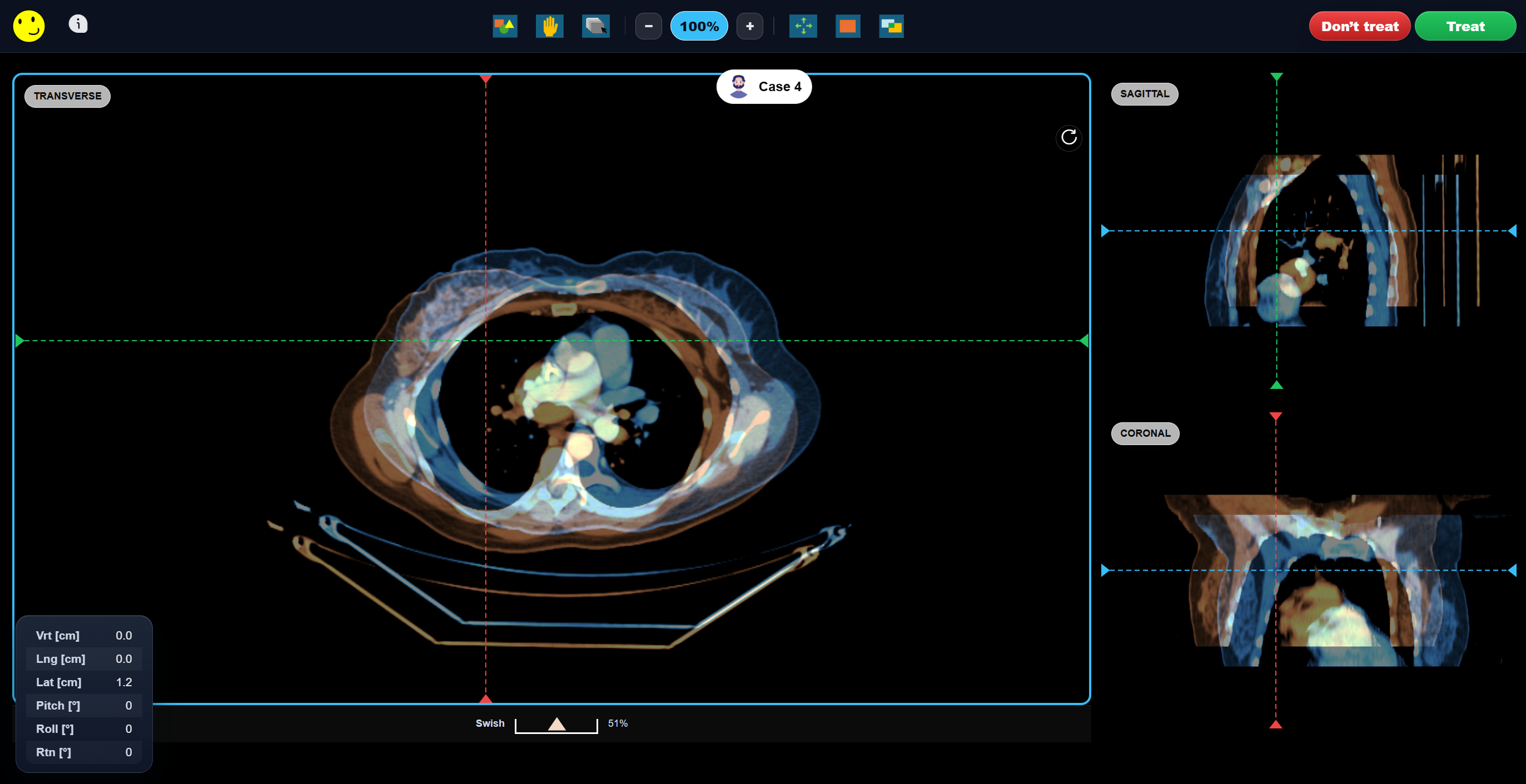 RadBudd Image Matching